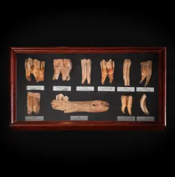 Collection of Pleistocene Mammalian Teeth – Fossilized Remnants from Siberia's Ice Age Giants